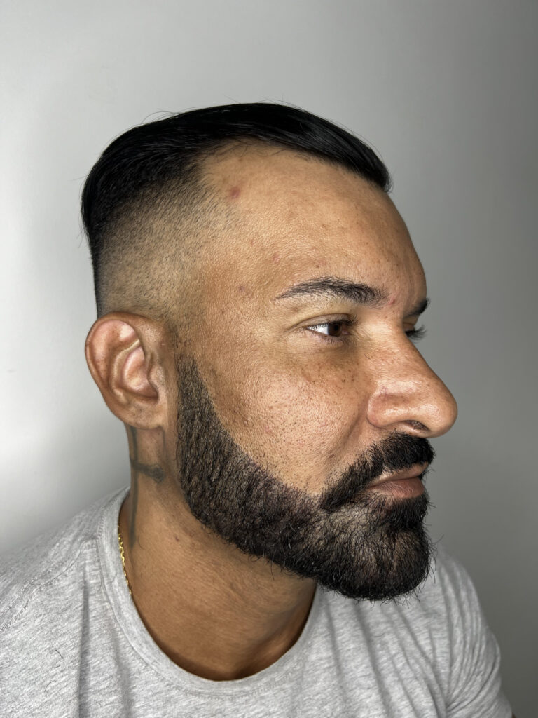 Micropigmentação em Barba - Fabiano SMP